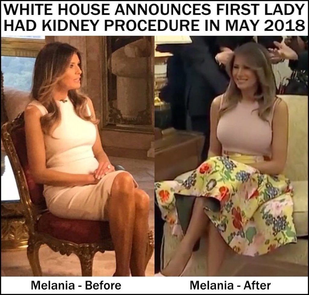 Click image for larger version

Name:	IMG_20180902_232702.jpg
Views:	104
Size:	400.2 KB
ID:	9358944