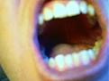 Click image for larger version

Name:	teeth.jpg
Views:	99
Size:	59.3 KB
ID:	8881375