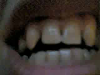 Click image for larger version

Name:	myteeth.jpg
Views:	111
Size:	9.7 KB
ID:	8906211