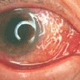 Click image for larger version

Name:	eye.gif
Views:	231
Size:	6.7 KB
ID:	8922028