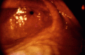 Click image for larger version

Name:	st-1.gif
Views:	129
Size:	19.5 KB
ID:	8922429