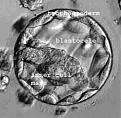 Click image for larger version

Name:	blastocyst.jpg
Views:	143
Size:	10.7 KB
ID:	8947929