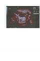 Click image for larger version

Name:	ultrababy.jpg
Views:	161
Size:	100.3 KB
ID:	8986555