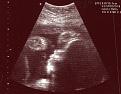 Click image for larger version

Name:	baby1.jpg
Views:	219
Size:	50.4 KB
ID:	8996526