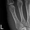 Click image for larger version

Name:	fracture.jpg
Views:	205
Size:	65.5 KB
ID:	9037693