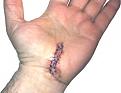 Click image for larger version

Name:	ctsurgery.jpg
Views:	126
Size:	10.6 KB
ID:	9061012