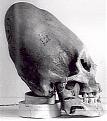 Click image for larger version

Name:	alienskull9.jpg
Views:	92
Size:	233.3 KB
ID:	9076369
