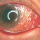 Click image for larger version

Name:	infect2.jpeg.jpg
Views:	263
Size:	10.7 KB
ID:	9125956