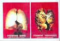 Click image for larger version

Name:	poumons.jpg
Views:	215
Size:	88.0 KB
ID:	9132888
